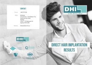 DHI brochure image Direct Hair implant results image